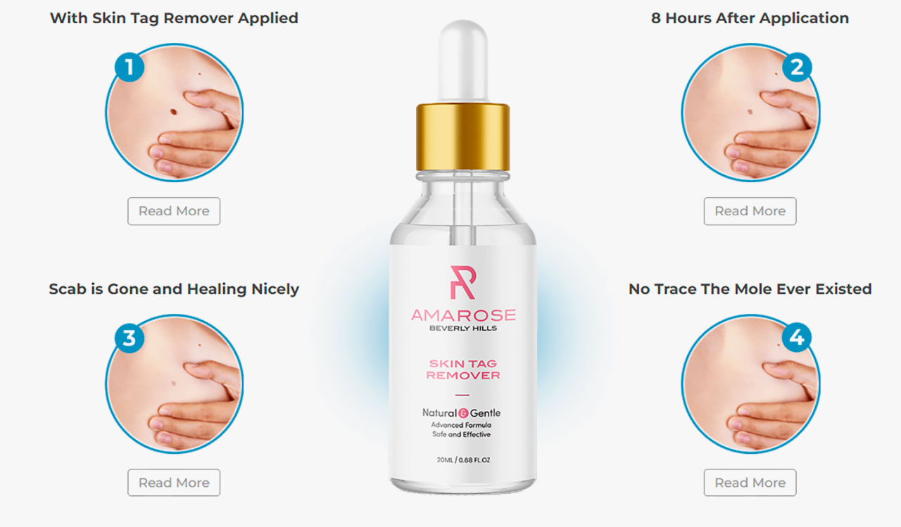 So Smooth Skin Tag Remover Prices