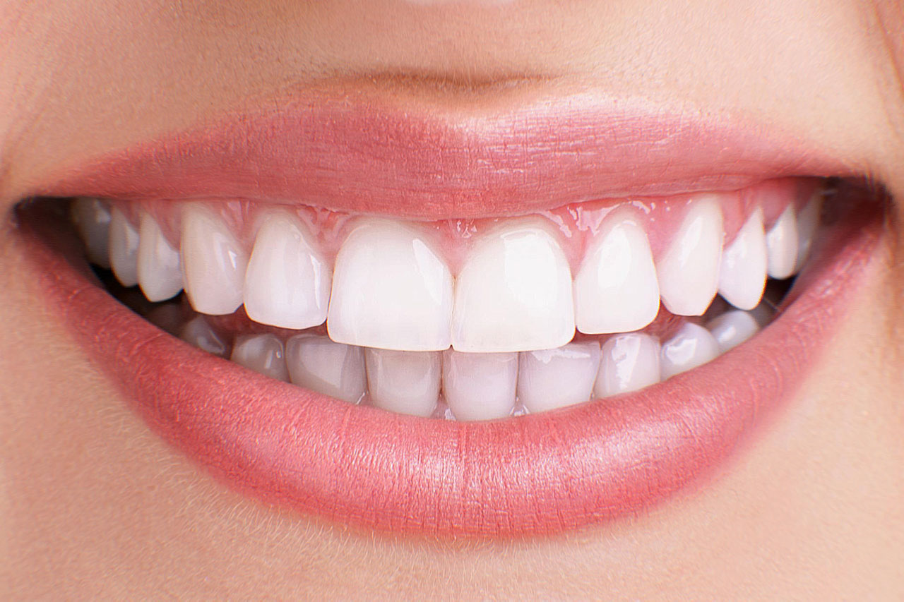 How to Keep Your Teeth & Gums Healthy