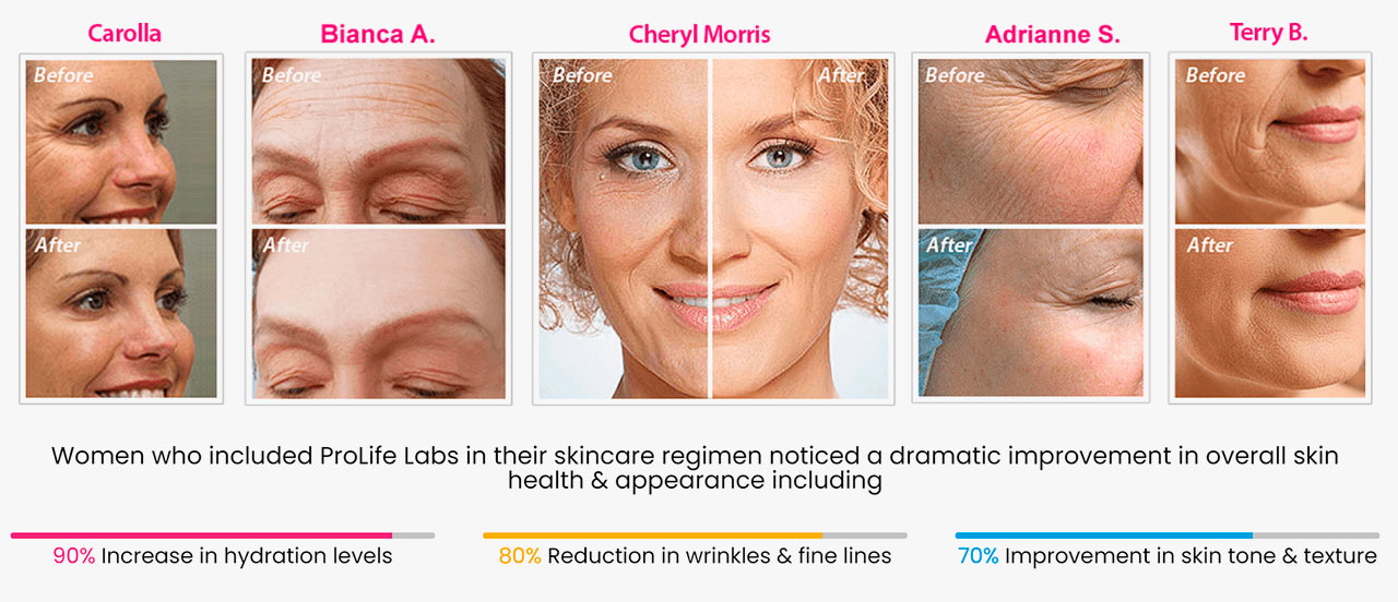 ProLife Labs Anti-Aging Reviews - Scam or Legit Youthful Essence Instant  Wrinkle Repair Cream?