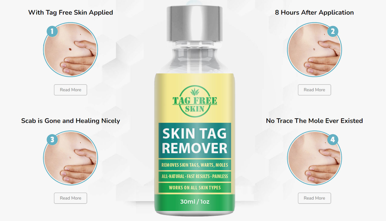 Tag Free Skin User Review
