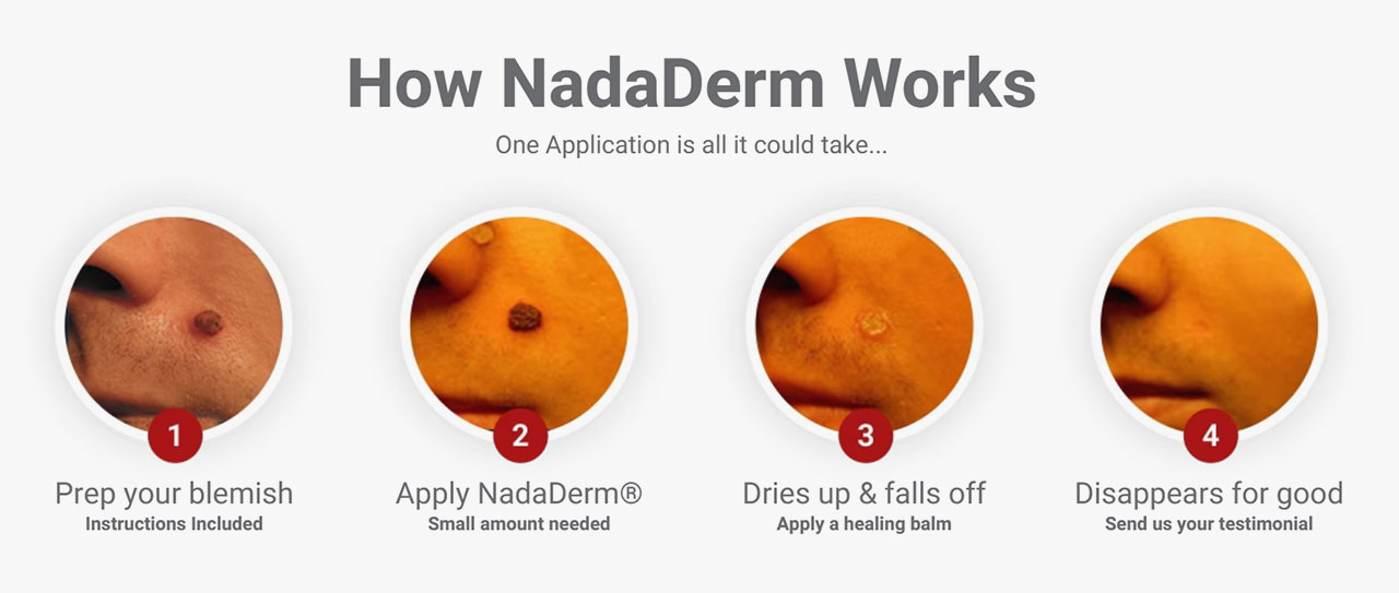 NadaDerm Cream Works